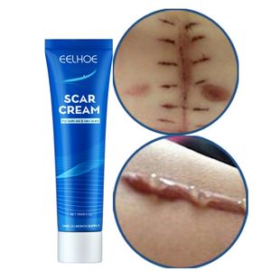 Produits de beauté pour la peau, crème réparatrice de la peau, crème éclaircissante pour les cicatrices, crème éclaircissante pour les brûlures, les marques de varicelle, crème lissante pour la peau, crème pour les cicatrices - Product Image 1