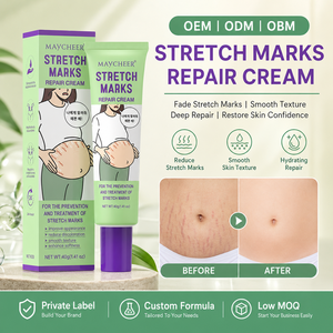 Crème Bio Anti-Vergetures MAYCHEER OEM&ODM, Raffermissante, Élimine les Cicatrices, Répare Post-partum, Hydratante - Product Image 1