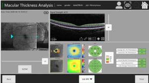 OCT-500 peralatan diagnostik pencitraan <span class=keywords><strong>Retinal</strong></span> presisi tinggi, pemindai tomografi moderen optik oftalik dengan garansi 1 tahun - Product Image 5