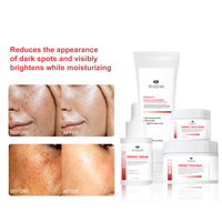 Set Perawatan Kulit pemutih wajah, Korea siang malam, pemutih Hitam bintik hitam pudar, menghilangkan noda kulit gelap, korektor Melasma