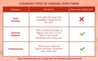 Tes Strip Deteksi Cepat pH Vagina Wanita Harga Terbaik Baru (Tes BV) Bakteri Vaginosis Penggunaan Manual Bersertifikat CE Kelas II