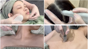 Beco 2 ב 1 microdermabrasion פילינג עור טיפול שאינו פולשני - Product Image 5