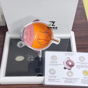 Modèle d'enseignement médical en PVC de l'anatomie de l'œil humain pour la cataracte - Product Image 5