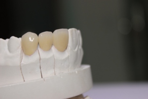 De alta calidad de CAD/CAM personalizado de circonio corona Dental - Product Image 4