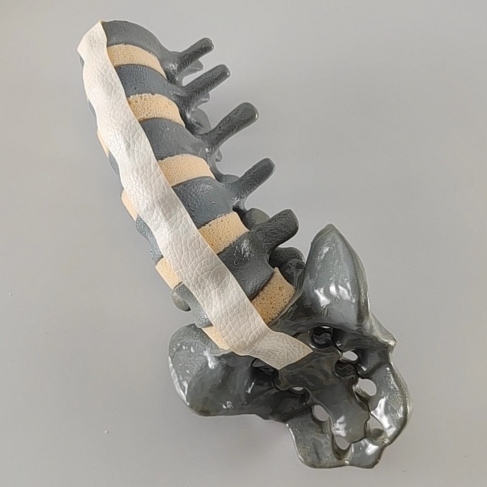 Lombaire 1 au sacrum, mousse solide, radio-opaque, imagerie 3D, modélisation