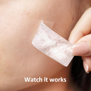 <strong>Hydrocollid</strong> Large Invisible Circle Pimple Patches for Full Face &amp; Body Waterproof Cruelty-Free Acne Treatment Custom Package CE - Product Image 3