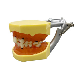 Tandheelkundig Model Voor Tandheelkundige Parodontale Pathologische Modelpraktijk Zachte Gingiva - Product Image 1