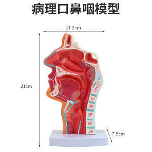 Modelo anatómico patológico de la cavidad nasal; modelo de enseñanza de otorrinolaringología; cavidad nasal; nariz; modelo de estructura oral-nasal - Product Image 1