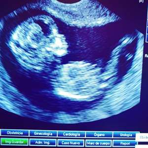 BW <span class=keywords><strong>Laptop</strong></span> <span class=keywords><strong>Ultrasound</strong></span> manusia portabel, penjualan laris 3D 4D <span class=keywords><strong>Digital</strong></span> penuh <span class=keywords><strong>Ultrasound</strong></span> - Product Image 3