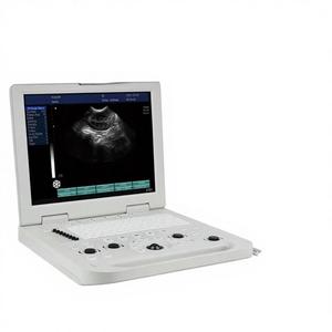 Ecógrafo Doppler Portátil a Color JINZHONG de Acero Inoxidable con Voltaje Universal para Pruebas de Embarazo en Hámsteres, Caballos y Ganado - Product Image 2