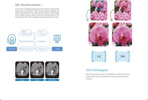 Équipement de radiologie YSCT755 CT 16 32 64 Scanner Ct Spiral Slice - Product Image 4