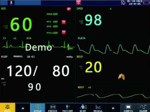 Свинец в отрасли Китай, оптовая продажа, Ветеринарный монитор для пациентов - Product Image 2