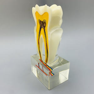 نموذج الفم 6 مرات نموذج عصب الأسنان مع تشريح الأعصاب للتعليم والعرض - Product Image 3