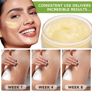 Natural Moisturizer Deep Hydration Manteca De Karite 100% Pure Raw Shea <strong>Butter</strong> For Extremely Dry Skin Body <strong>Butter</strong> - Product Image 3