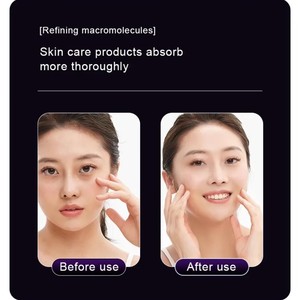 Masajeador Facial y de Cuello Recargable, Impermeable, con Vibración para Uso Doméstico, con Frecuencia Ajustable S1 - Product Image 5