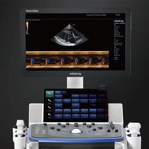 Échographe vétérinaire Mindray Vetus 8exp de haute qualité sur chariot avec sonde multifréquence pour l'utilisation en cliniques vétérinaires - Product Image 3