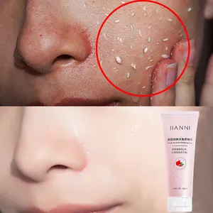 피부 관리 빛나는 과일 산성 얼굴 떨어지게 하는 젤 죽은 피부 제거제 유기 Exfoliator 얼굴 제거를 희게하는 숨구멍을 극소화하십시오