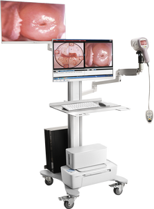 Vidéo de biopsie de colposcopie cervicale féminine vérifiant pour l'examen gynécologique Colposcope vaginal vidéo pour la gynécologie - Product Image 4