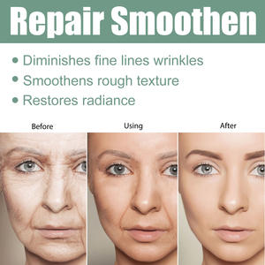 Private <b>Label</b> Collagen Skin Care Serum Whitening Anti Age Acne Anti-wrinkle Facial Serum for Face with Hyaluronic Acid 30 ml - Product Image 3