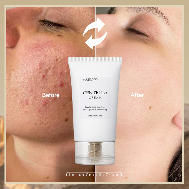 glutathione super whitening face cream Hot Sale Glutathione Whitening Face and Body Cream Super Lightening  Centella Acne Face Cream for Women| Alibaba.com