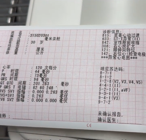 Electrocardiógrafo Veterinario Portátil de 3 a 6 Canales con Pantalla de 7 Pulgadas para Hospital de Animales, Clínica Veterinaria y Monitoreo del Ritmo Cardíaco - Product Image 6