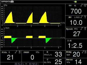 Ventilador médico STD, ventilador Médico <span class=keywords><strong>de</strong></span> Clínica Icu, ventilador <span class=keywords><strong>de</strong></span> respiración <span class=keywords><strong>de</strong></span> emergencia para equipo <span class=keywords><strong>de</strong></span> UCI - Product Image 5