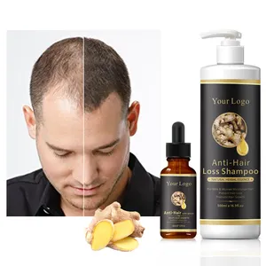 Oem Private Label Wholesale Organic Anti Dandruff Anti Hair Loss Ginger Hair Growth Shampoo