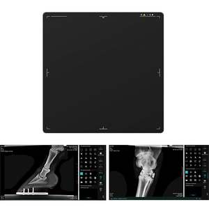 Iray 17*17 filaire De Radiologia numérique écran plat Csi médical Dr détecteur à écran plat pour la radiologie MSLFP20 - Product Image 2