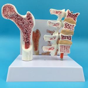 Modèle d'anatomie de l'ostéoporose du fémur humain PVC jambe os coupe transversale tranche vertébrale pathologique vertèbres lombaires pour la science médicale - Product Image 5