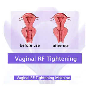 Nouvel équipement de beauté 2026, <span class=keywords><strong>Appareil</strong></span> de resserrement vaginal <span class=keywords><strong>pour</strong></span> salon de beauté, Personnalisation grand écran de dispositifs médicaux privés <span class=keywords><strong>pour</strong></span> les clients - Product Image 2
