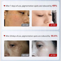 Best-seller - Ensemble de soin pour éliminer les taches noires et les taches brunes - Correcteur de teint - Traitement du mélasma - Gommage chimique pour le visage - Kits professionnels 3 en 1