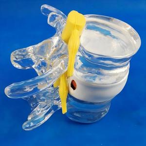 Anatomi Öğretimi için İntervertebral Disk Sıkıştırma Göstergeli Şeffaf İnsan Bel Omuru Modeli - Product Image 2