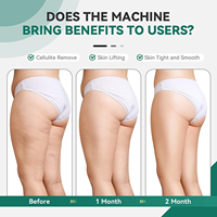 Mini Masajeador Vibratorio Portátil para Eliminar Grasa, Quemar Celulitis, Adelgazar el Cuerpo, Masajeador de Grasa Abdominal