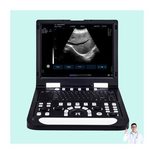 เครื่องอัลตราซาวนด์ N60 ขาวดำ พร้อมระบบภาพประกอบในตัว หัวตรวจแบบโค้ง สำหรับใช้ในสัตว์และมนุษย์ ตรวจตับและ<span class=keywords><strong>ไต</strong></span> - Product Image 1
