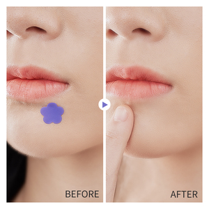 KORMESIC 20 unids/caja venta al por mayor hidrocoloide cuidado de la piel parche para acné impermeable colorido flor estrella curación acné espinillas parche - Product Image 3