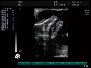 Échographe vétérinaire haute performance MC1000Vet pour le diagnostic de gestation animale, la santé de la vésicule biliaire, des reins, de la vessie et de l'<span class=keywords><strong>utérus</strong></span> - Product Image 4