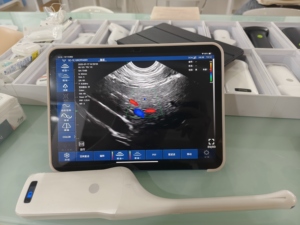 Ecógrafo Veterinario Portátil DMU92, Ginecología/Endovaginal, Wifi, Inalámbrico, Escáner Transvaginal para Humanos/Veterinarios - Product Image 6