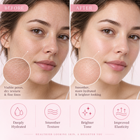 Sérum Ampoule Visage Coréen Anti-Âge et Anti-Rides au PDRN de Saumon, Peptides et Exosomes pour Peaux à Problèmes d'Acné – Hydratant et Soin de Marque Privée
