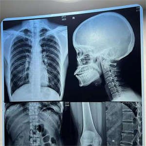 Film radiographique bleu à jet d'encre 10x12 pouces, vente chaude, film médical à base de PET pour le service de <span class=keywords><strong>radiologie</strong></span> hospitalier - Product Image 5