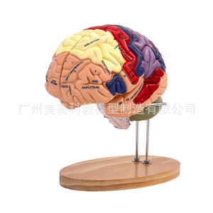 Modèle d'artère cérébrale à 4 parties avec grossissement 2x, modèle de vaisseaux sanguins cérébraux, modèle d'anatomie du cerveau humain neurologique - Product Image 2