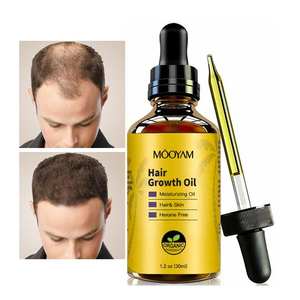 น้ำมันปลูกผมสำหรับผู้หญิงน้ำมันปลูกผมออร์แกนิกสำหรับผมร่วงฉลากส่วนตัวกำหนดโลโก้ได้เอง - Product Image 5