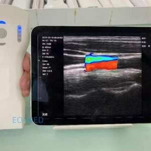 Échographe portable sans fil 3-en-1 DCU19H avec sonde USG à 192 éléments et 64 canaux, et Doppler vétérinaire - Product Image 6