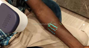 <span class=keywords><strong>Buscador</strong></span> <span class=keywords><strong>de</strong></span> venas infrarrojo portátil con el precio más barato - Product Image 2