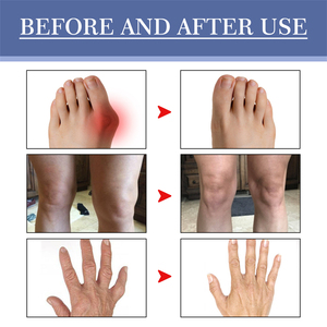 Gel réparateur articulaire à marque privée pour l'élimination des kystes et de l'œdème, améliorant la flexibilité, soulageant la douleur et réparant les tissus articulaires - Product Image 5