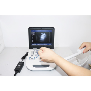 Diagnostic SY-AX50 12. Système d'ultrason vasculaire de pouce B & W avec la <span class=keywords><strong>sonde</strong></span> <span class=keywords><strong>vaginale</strong></span> - Product Image 2