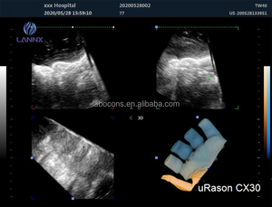 Lannx urason CX30เครื่องอัลตราซาวด์128องค์ประกอบที่มีประสิทธิภาพสูงสุดเครื่องสแกนสี Doppler 2D/3D เครื่องอัลตราซาวด์ตัวเลือก - Product Image 4