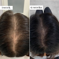 Kit de Traitement Anti-Chute de Cheveux Multi-Peptides pour la Repousse Rapide et l'Augmentation de la Densité Capillaire (3+1 unités)