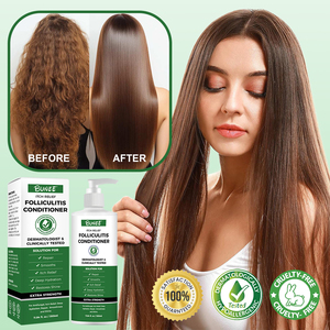 250ml Shampooing crème nourrissante rafraîchissante pour folliculite cuir chevelu <span class=keywords><strong>psoriasis</strong></span> séborrhéique conditionneur liquide à base de plantes hydratant - Product Image 2