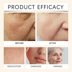 Crema Facial Orgánica <span class=keywords><strong>de</strong></span> Marca Privada <span class=keywords><strong>para</strong></span> Aclarar <span class=keywords><strong>la</strong></span> <span class=keywords><strong>Piel</strong></span> y Humectarla Profundamente, Crema Facial Nocturna Blanqueadora Personalizada <span class=keywords><strong>para</strong></span> Eliminar Pecas - Product Image 2