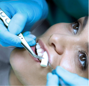 Rotolo di cotone assorbente dentale rotolo di cotone dentale assorbente monouso per uso medico - Product Image 6